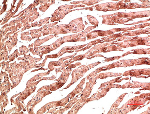 VE-Cadherin Mouse Monoclonal Antibody(3G8)