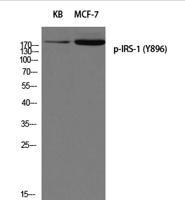 IRS-1 (phospho Tyr896) Polyclonal Antibody