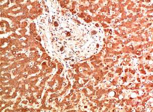Collagen IV Mouse Monoclonal Antibody(5C9)