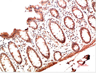 Collagen I Mouse Monoclonal Antibody(1B2)