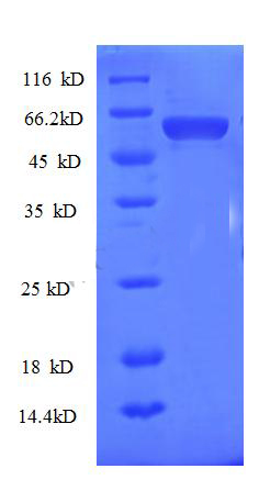 Recombinant Human Protein AATF