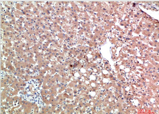 TTR Mouse Monoclonal Antibody(3B5)