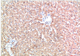 TTR Mouse Monoclonal Antibody(10D8)