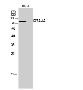 CYP21A2 Polyclonal Antibody