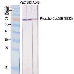 Cdc25B (phospho Ser323) Polyclonal Antibody