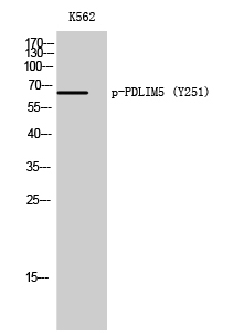 PDLIM5 (phospho Tyr251) Polyclonal Antibody