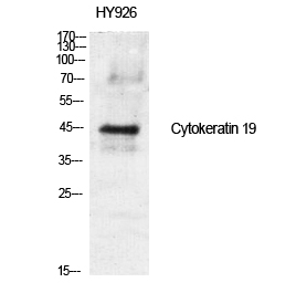 Cytokeratin 19 Polyclonal Antibody