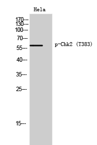 Chk2 (phospho Thr383) Polyclonal Antibody