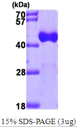 ACAA1, 27-424aa, Human, His tag, E Coli