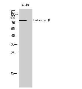 Catenin-β Polyclonal Antibody