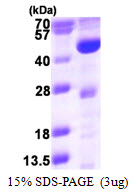 ACADL, 31-430aa, Human, His tag, E Coli