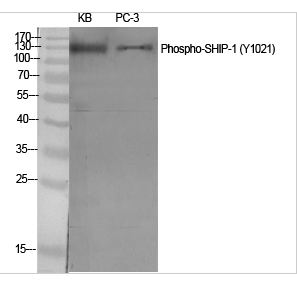 SHIP-1 (phospho Tyr1021) Polyclonal Antibody