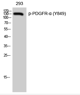 PDGFR-α (phospho Tyr849) Polyclonal Antibody