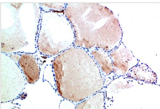 TTR Mouse Monoclonal Antibody(9B5)