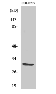 ABHD11 Polyclonal Antibody