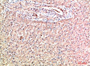 TTR Mouse Monoclonal Antibody(5G9)