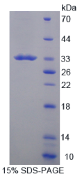 Recombinant Cluster Of Differentiation 19 (CD19)