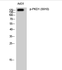 PKD1 (phospho Ser910) Polyclonal Antibody