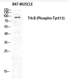 Trk B (phospho Tyr516) Polyclonal Antibody