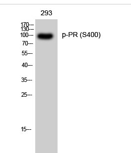 PR (phospho Ser400) Polyclonal Antibody