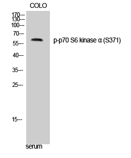 p70 S6 kinase α (phospho Ser371) Polyclonal Antibody