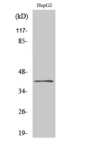ChoKB Polyclonal Antibody