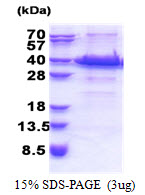 ACBD6, 1-282aa, Human, His tag, E Coli