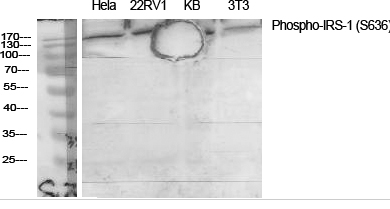 IRS-1 (phospho Ser636) Polyclonal Antibody