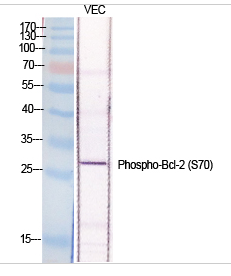 Bcl-2 (phospho Ser70) Polyclonal Antibody