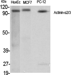 Actinin-α2/3 Polyclonal Antibody