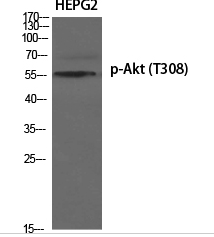 Akt (phospho Thr308) Polyclonal Antibody