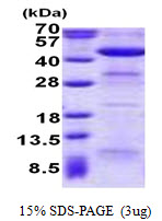 ACAA2, 17-397aa, Human, His tag, E Coli