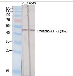 ATF-2 (phospho Ser62) Polyclonal Antibody