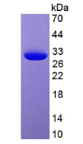 Eukaryotic Green fluorescent protein (GFP)