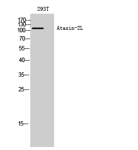 Ataxin-2L Polyclonal Antibody