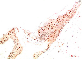 ATG14L Rabbit Polyclonal Antibody