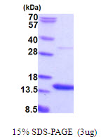 AAMDC, 1-122aa Human, His tag, E Coli