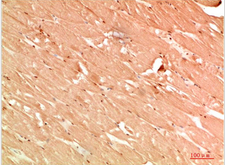 ATG13 Rabbit Polyclonal Antibody