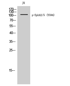 EphA2/5 (phospho Tyr594) Polyclonal Antibody