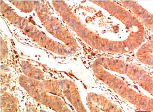 Acetyl P53(K382) Mouse Monoclonal Antibody(1G7)