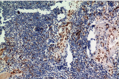 ERK1 Mouse Monoclonal Antibody(4G11)
