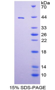 Recombinant A Disintegrin And Metalloprotease 8 (ADAM8)