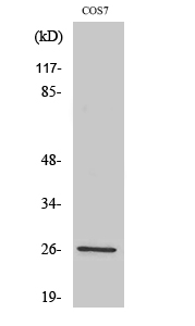 AQP2 Polyclonal Antibody