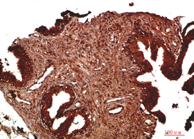 ATM Rabbit Polyclonal Antibody
