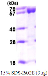 ACADVL, 41-655aa, Human, His tag, E Coli