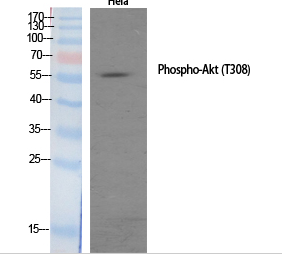 Akt (phospho Thr308) Polyclonal Antibody