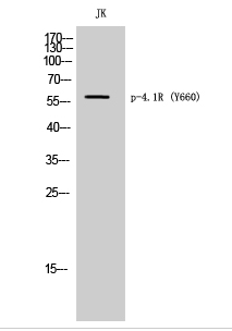 4.1R (phospho Tyr660) Polyclonal Antibody