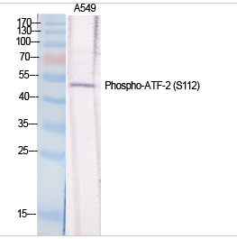ATF-2 (phospho Ser112) Polyclonal Antibody