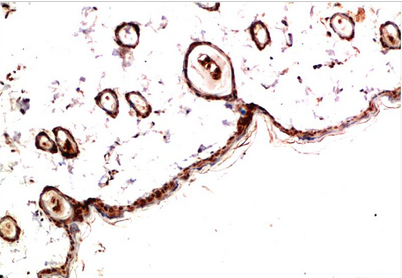 PDGFRα Mouse Monoclonal Antibody(4G11)