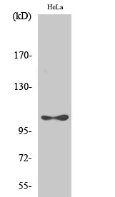 eEF2K (phospho Ser366) Polyclonal Antibody
